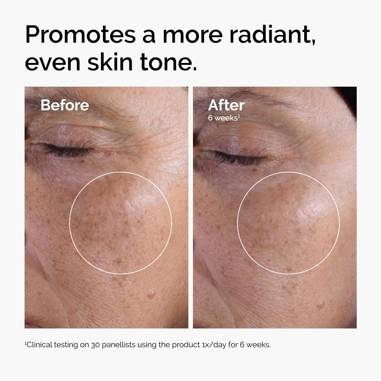 The Ordinary Glycolic Acid 7% Toning Solution 240ml exfoliating toner use result